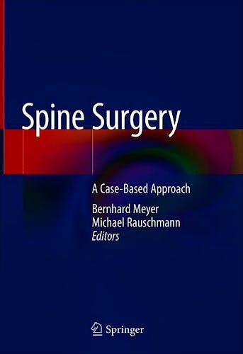 Portada del libro 9783319988740 Spine Surgery. A Case-Based Approach