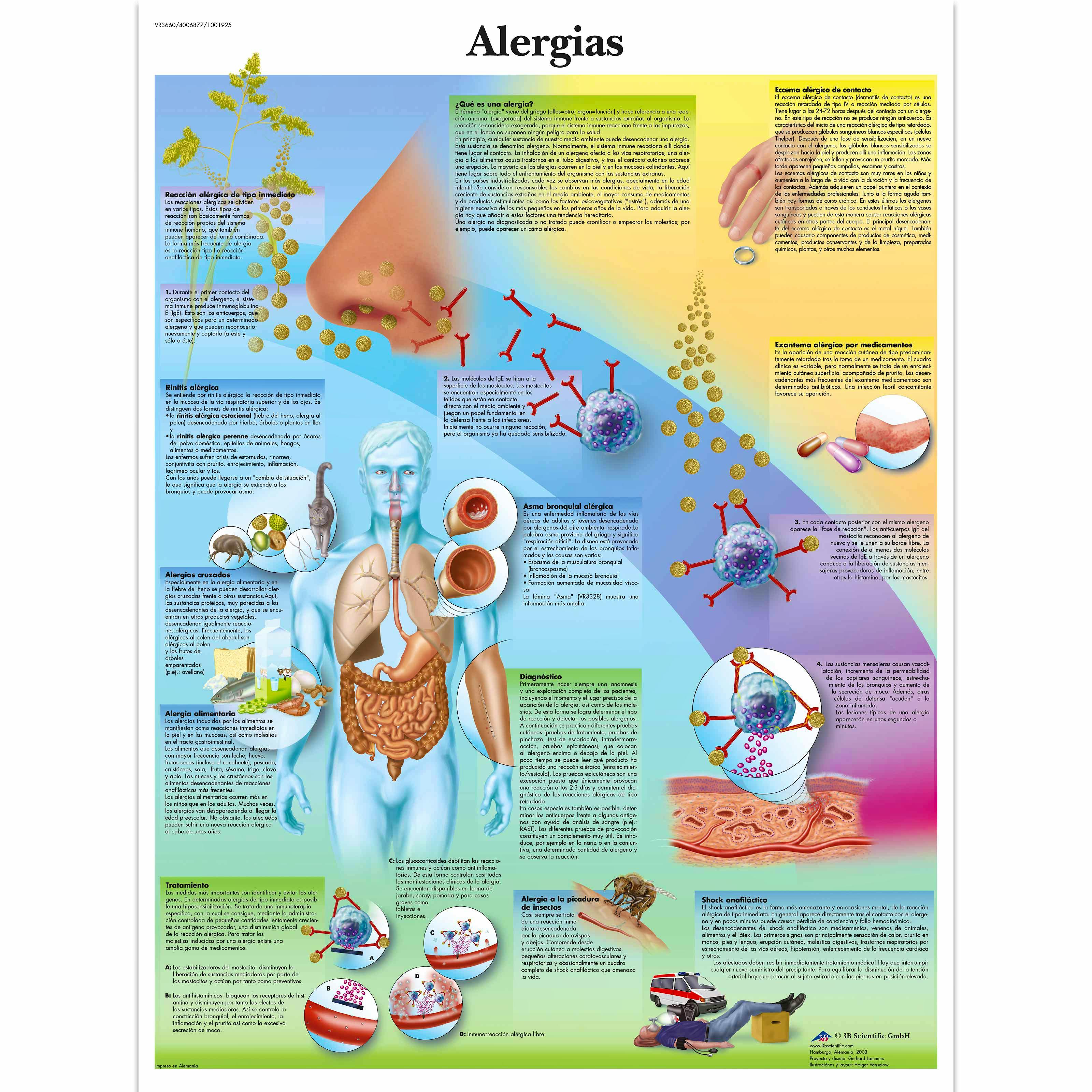 Lámina Alergias (formato 50 x 67 cm)