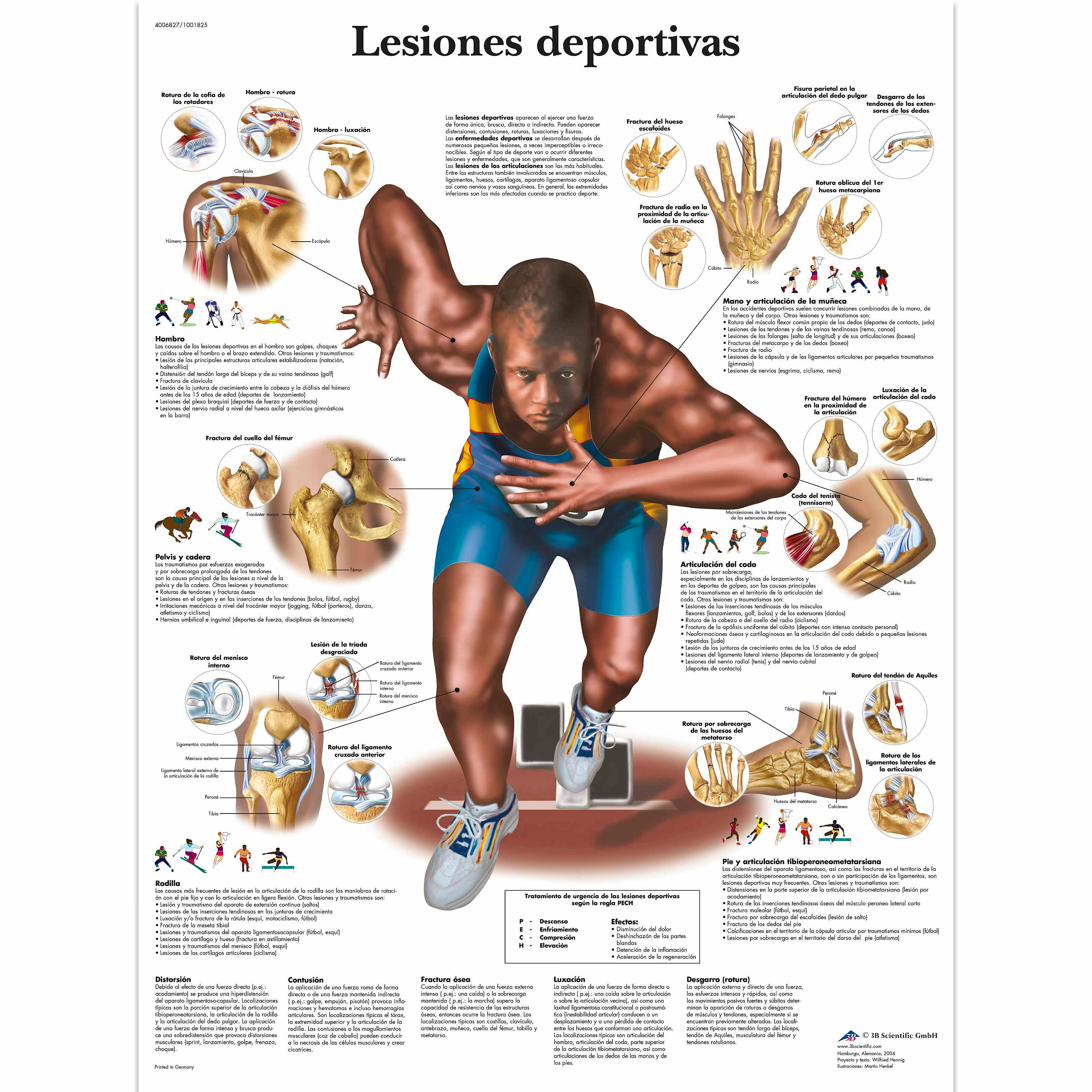Lámina Lesiones Deportivas (formato 50 x 67 cm)