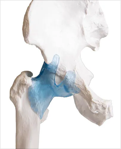 Articulación de la Cadera con Ligamentos, con Soporte