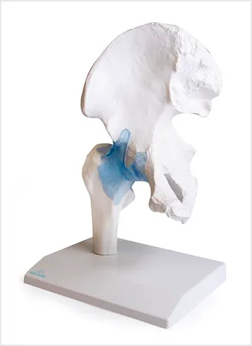 Articulación de la Cadera con Ligamentos, con Soporte