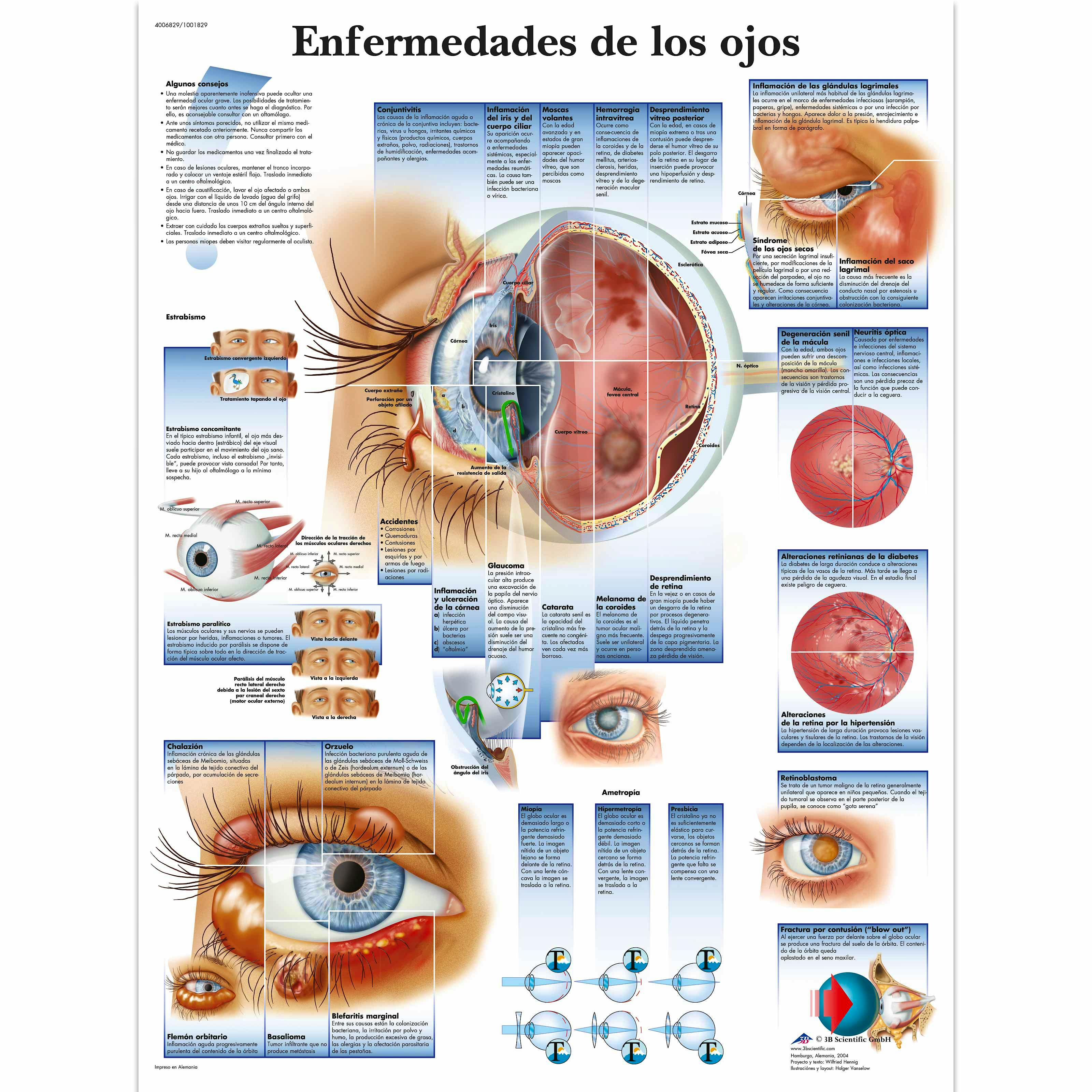 Lamina Enfermedades de los Ojos (formato 50 x 67 cm)