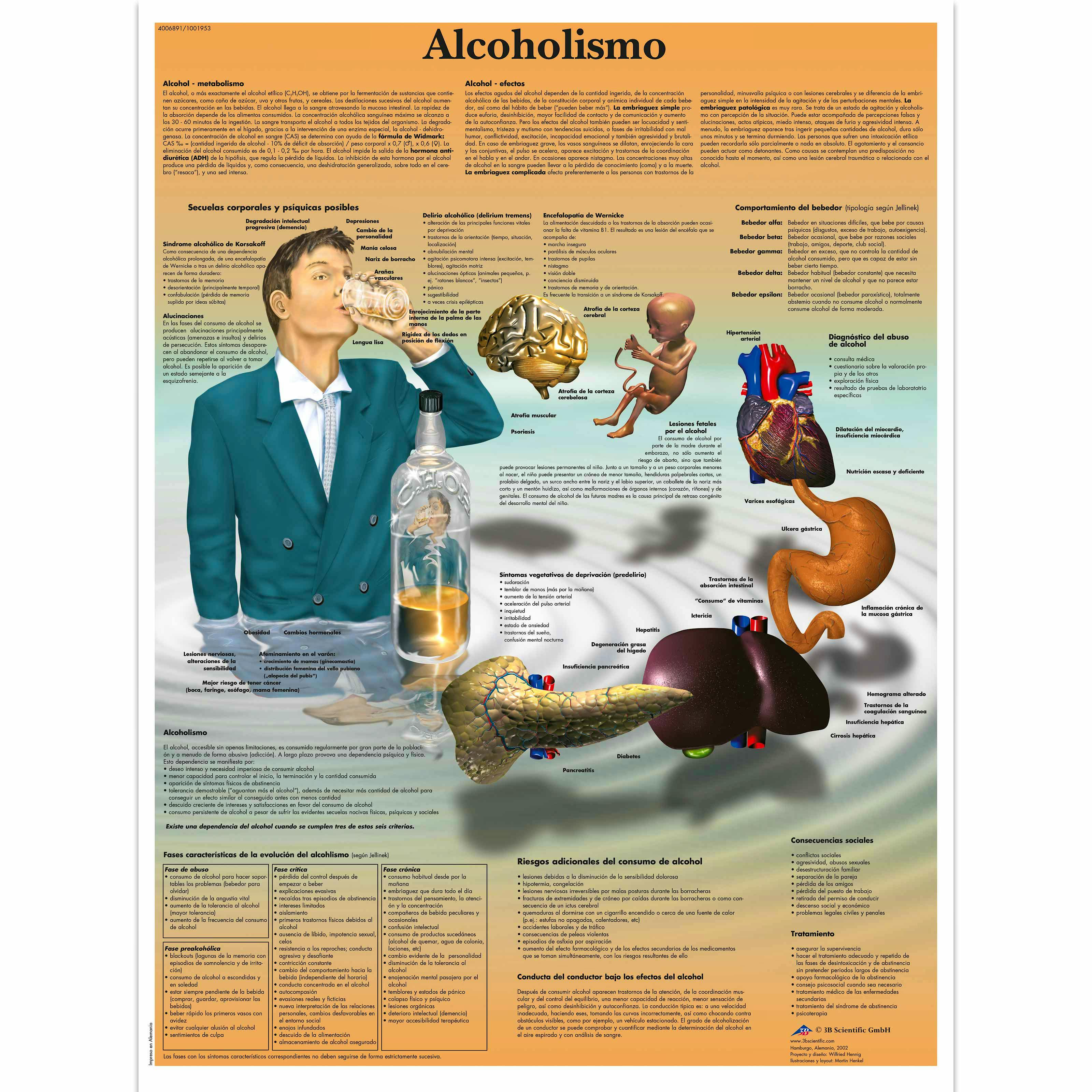 Lamina Alcoholismo (formato 50 x 67 cm)