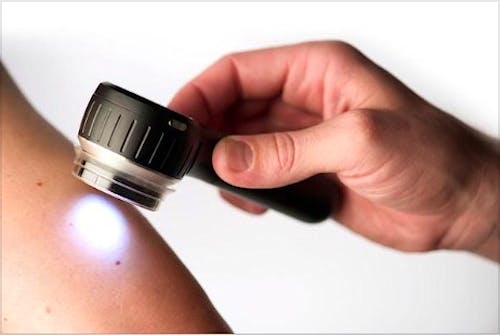 Dermatoscopio Dermlite DL4W