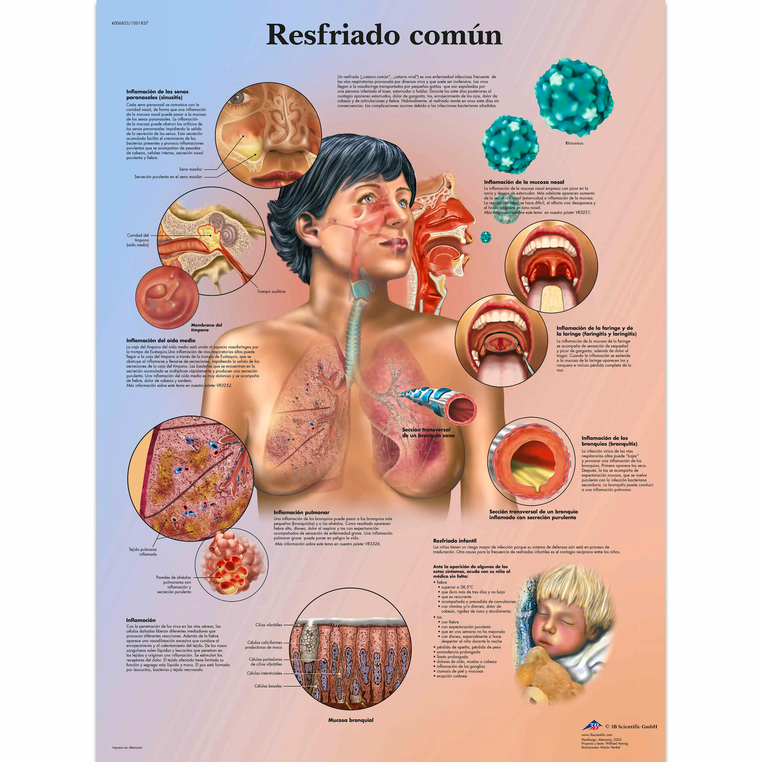 Lamina Resfriado Comun (formato 50 x 67 cm)