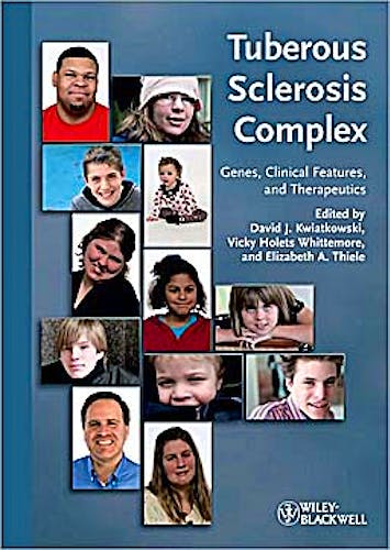 Portada del libro 9783527322015 Tuberous Sclerosis Complex. Genes, Clinical Features and Therapeutics