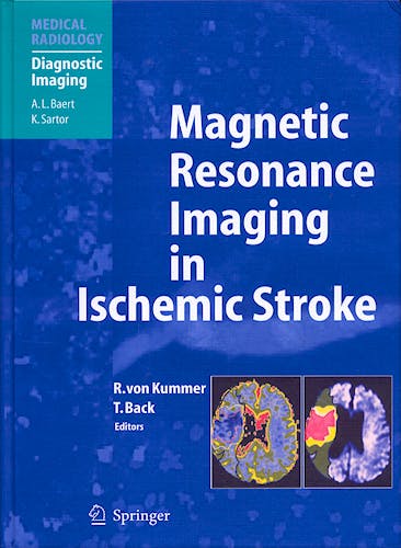 Portada del libro 9783540008613 Magnetic Resonance Imaging in Ischemic Stroke (Medical Radiology: Diagnostic Imaging)