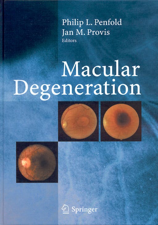 Portada del libro 9783540200581 Macular Degeneration