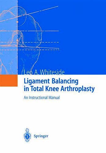 Portada del libro 9783540207498 Ligament Balancing in Total Knee Arthroplasty. an Instruction Manual