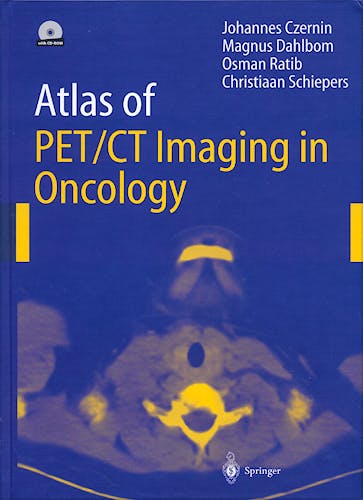 Portada del libro 9783540209522 Atlas of Pet/ct Imaging in Oncology