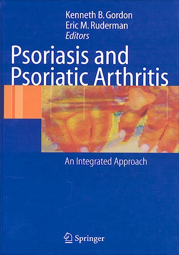 Portada del libro 9783540212805 Psoriasis & Psoriatic Arthritis: An Integrated Approach