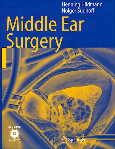 Portada del libro 9783540222019 Middle Ear Surgery