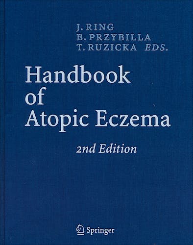 Portada del libro 9783540231332 Handbook of Atopic Eczema