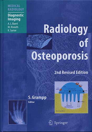 Portada del libro 9783540258889 Radiology of Osteoporosis