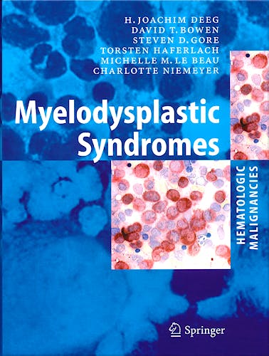 Portada del libro 9783540261889 Myelodysplastic Syndromes (Hematologic Malignancies)