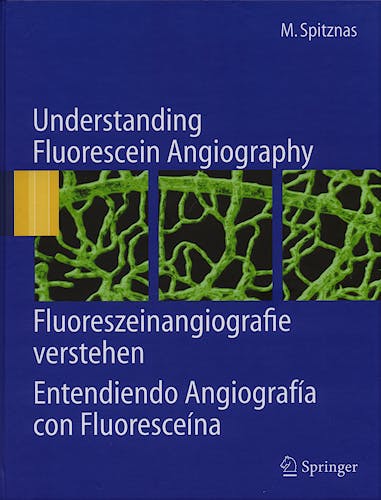 Portada del libro 9783540300601 Understanding Fluorescein Angiography