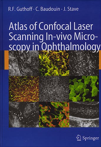 Portada del libro 9783540327059 Atlas of Confocal Laser Scanning In-Vivo Microscopy in Ophtalmology