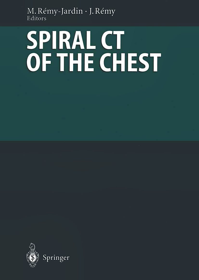 Portada del libro 9783540411765 Spiral CT of the Chest