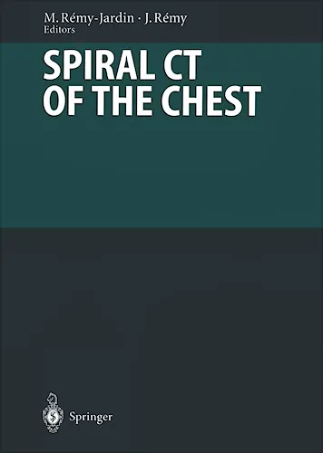 Portada del libro 9783540411765 Spiral CT of the Chest