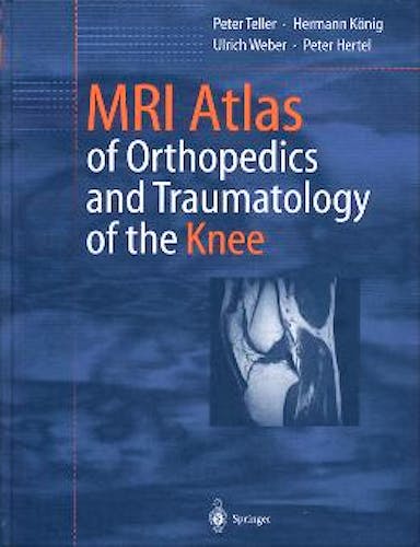 Portada del libro 9783540440345 Mri Atlas of Orthopedics and Traumatology of the Knee
