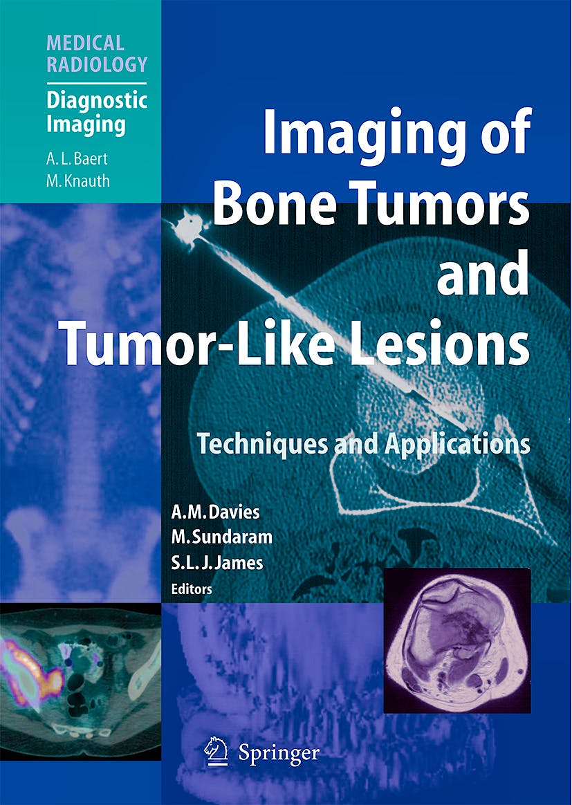 Portada del libro 9783540779827 Imaging of Bone Tumors and Tumor-Like Lesions. Techniques and Applications (Medical Radiology: Diagnostic Imaging)