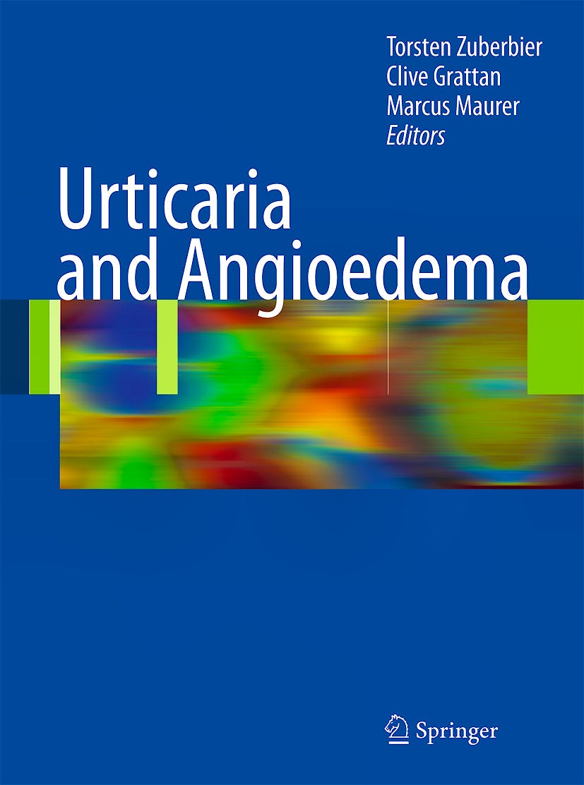 Portada del libro 9783540790471 Urticaria and Angioedema