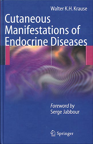Portada del libro 9783540883661 Cutaneous Manifestations of Endocrine Diseases