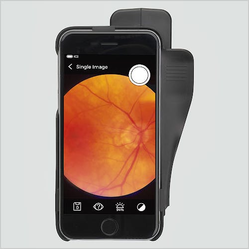 Funduscopio Heine IC2 Set/6 para Captura de Imágenes del Fondo del Ojo, C/carcasa-Adaptador para Iphone 6/6s