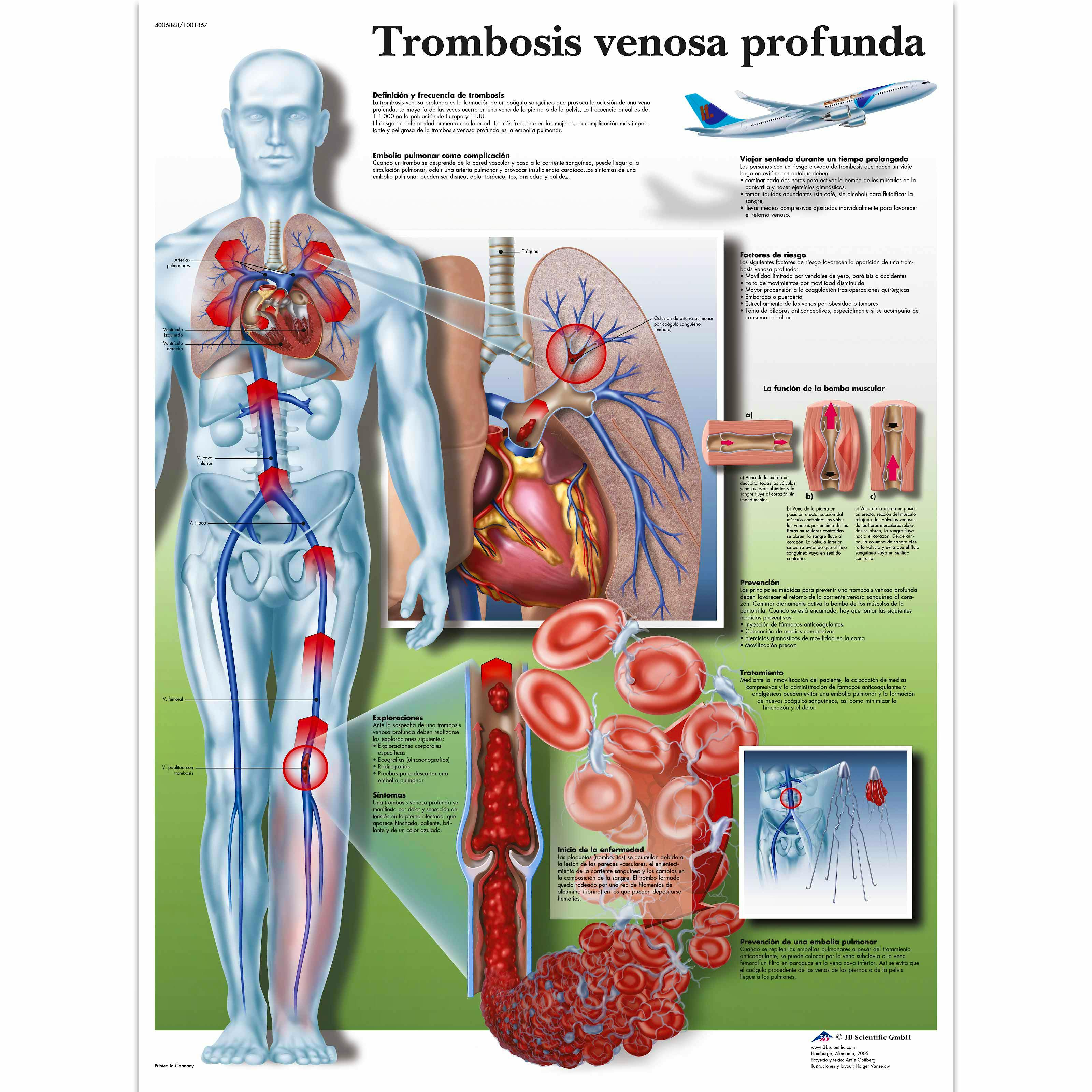 Lamina Trombosis (formato 50 x 67 cm)