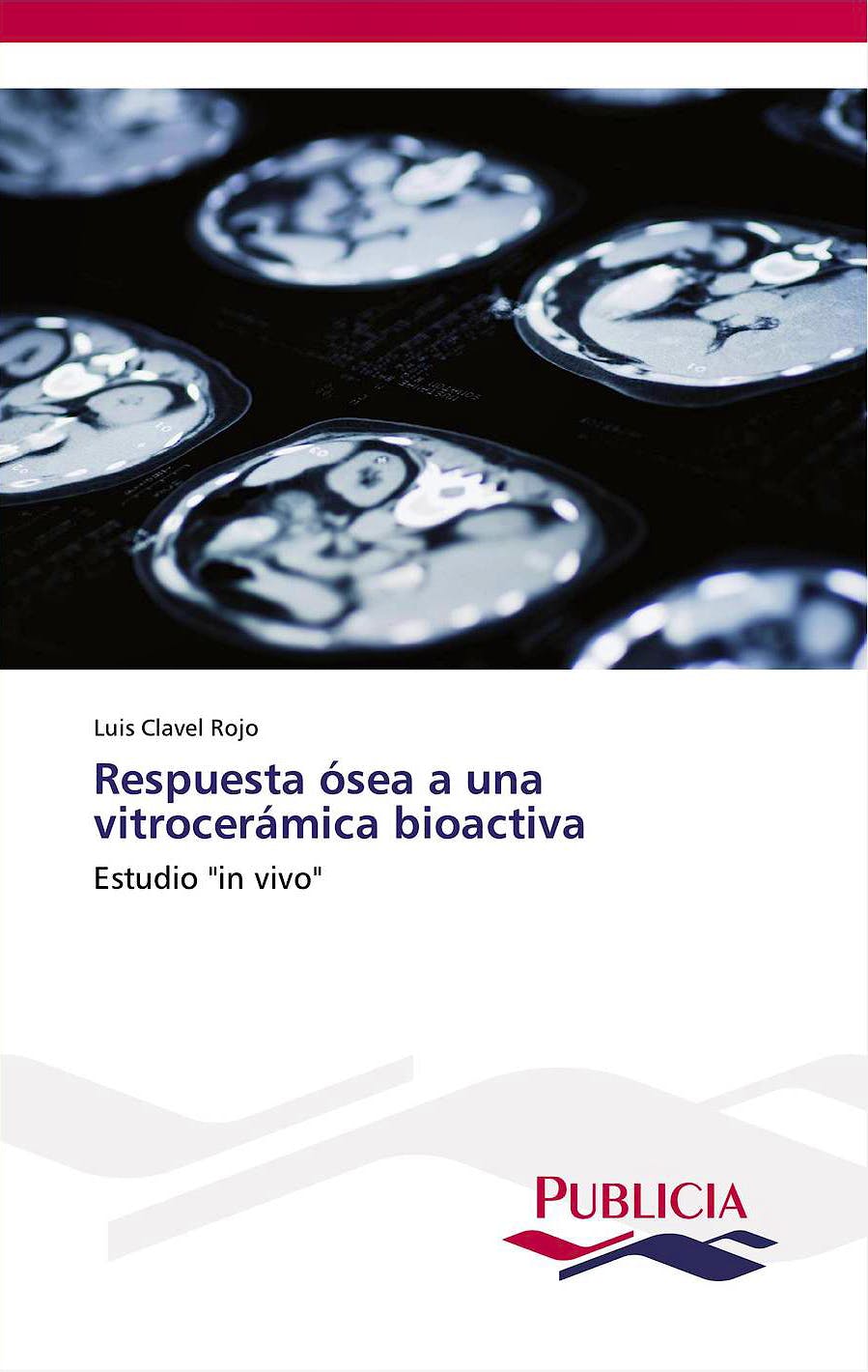 Portada del libro 9783639554953 Respuesta Osea a una Vitroceramica Bioactiva. Estudio "In Vivo"