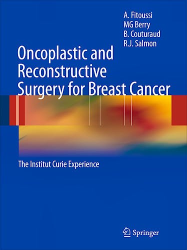 Portada del libro 9783642001437 Oncoplastic and Reconstructive Surgery for Breast Cancer. the Institut Curie Experience