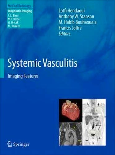 Portada del libro 9783642024832 Systemic Vasculitis. Imaging Features (Medical Radiology: Diagnostic Imaging)