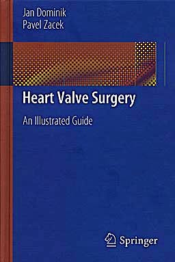 Portada del libro 9783642122057 Heart Valve Surgery. an Illustrated Guide