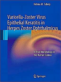 Portada del libro 9783642144868 Varicella-Zoster Virus Epithelial Keratitis in Herpes Zoster Ophthalmicus. in Vivo Morphology in the Human Cornea