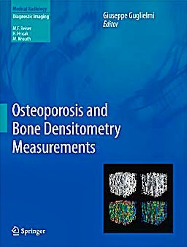 Portada del libro 9783642278839 Osteoporosis and Bone Densitometry Measurements (Medical Radiology: Diagnostic Imaging)