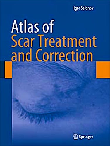 Portada del libro 9783642291951 Atlas of Scar Treatment and Correction