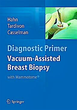 Portada del libro 9783642342707 Vacuum-Assisted Breast Biopsy with Mammotome