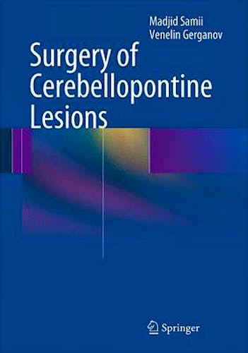 Portada del libro 9783642354212 Surgery of Cerebellopontine Lesions