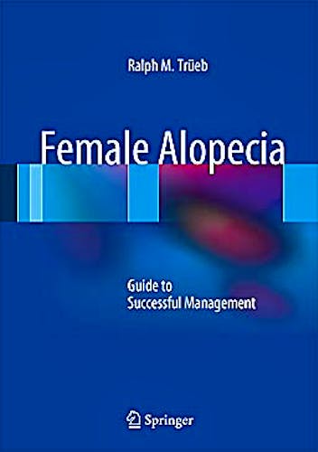 Portada del libro 9783642355028 Female Alopecia. Guide to Successful Management