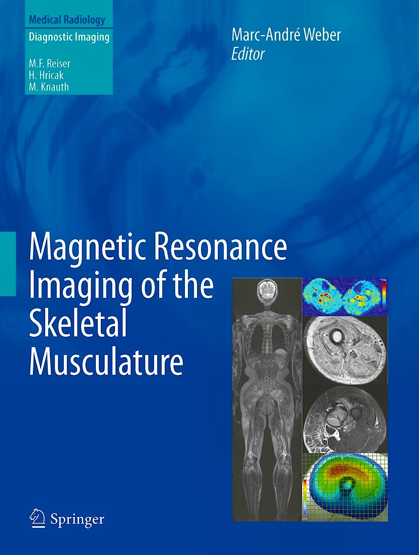 Portada del libro 9783642372186 Magnetic Resonance Imaging of the Skeletal Musculature (Medical Radiology: Diagnostic Imaging)