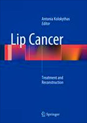 Portada del libro 9783642381799 Lip Cancer. Treatment and Reconstruction