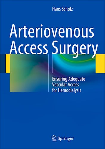Portada del libro 9783642411380 Arteriovenous Access Surgery. Ensuring Adequate Vascular Access for Hemodialysis