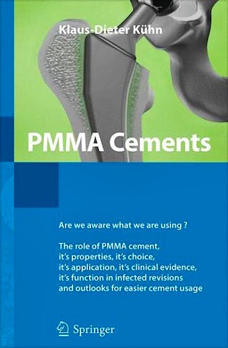 Portada del libro 9783642415357 Pmma Cements