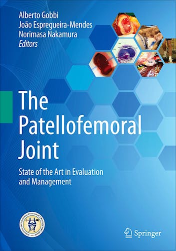 Portada del libro 9783642549649 The Patellofemoral Joint. State of the Art in Evaluation and Management