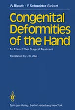 Portada del libro 9783642676567 Congenital Deformities of the Hand. An Atlas of Their Surgical Treatment