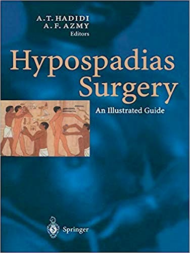 Portada del libro 9783662078433 Hypospadias Surgery. An Illustrated Guide
