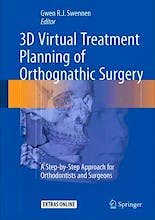 3d Virtual Treatment Planning of Orthognathic Surgery. a Step-by-Step Approach for Orthodontists and Surgeons