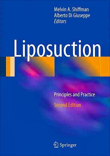 Portada del libro 9783662489017 Liposuction. Principles and Practice