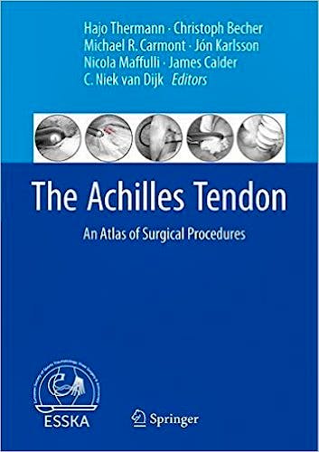 Portada del libro 9783662540732 The Achilles Tendon. An Atlas of Surgical Procedures