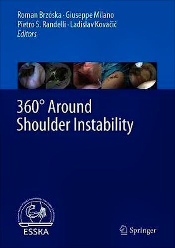 Portada del libro 9783662610732 360° Around Shoulder Instability